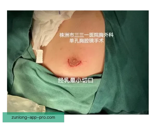 坎宁安气胸康复持续推进 活塞计划一周后复查评估 坎宁安气胸康复持续推进 活塞计划一周后复查评估